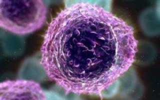 Чем отличаются лейкоциты от лимфоцитов