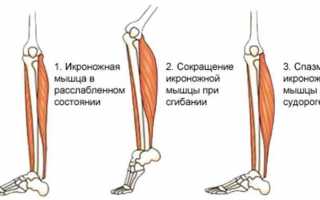 Судороги мышц ног причины и лечение