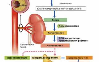 Ренальная артериальная гипертензия
